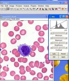 Imagej
