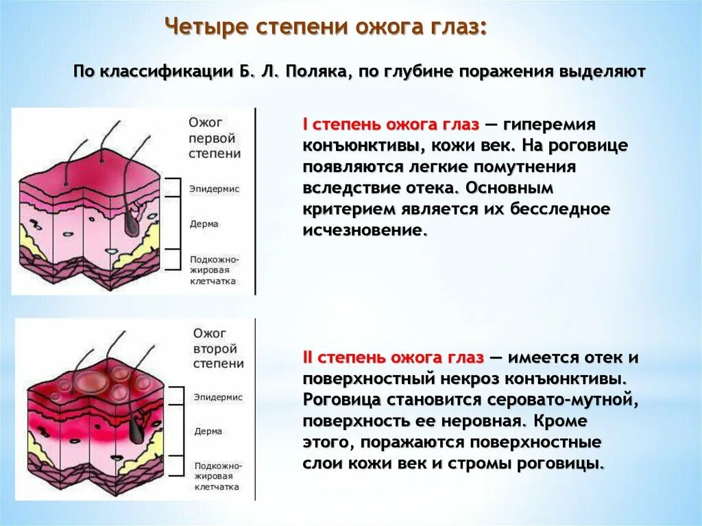 Установите соответствие степени ожога. Классификация ожогов по степени поражения. Классификация ожогов глаз. Ожоги классификация по глубине поражения. Классификация ожогов по глубине поражения.