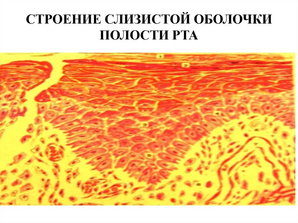 Слизистая оболочка полости рта (сопр). Строение слизистой оболочки полости. Слизистая оболочка полости рта строение. Строение слизистой оболочки рта. Слои слизистой полости рта