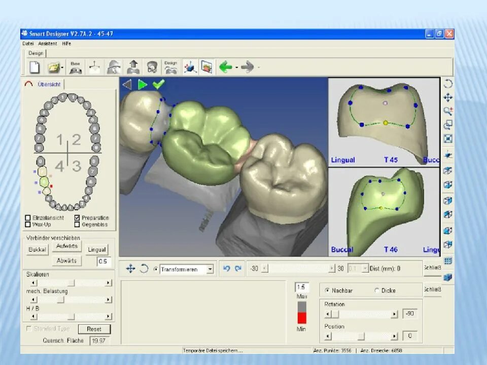 Cad cam моделирование. Моделирование в cad/cam системах. cad cam коронки.