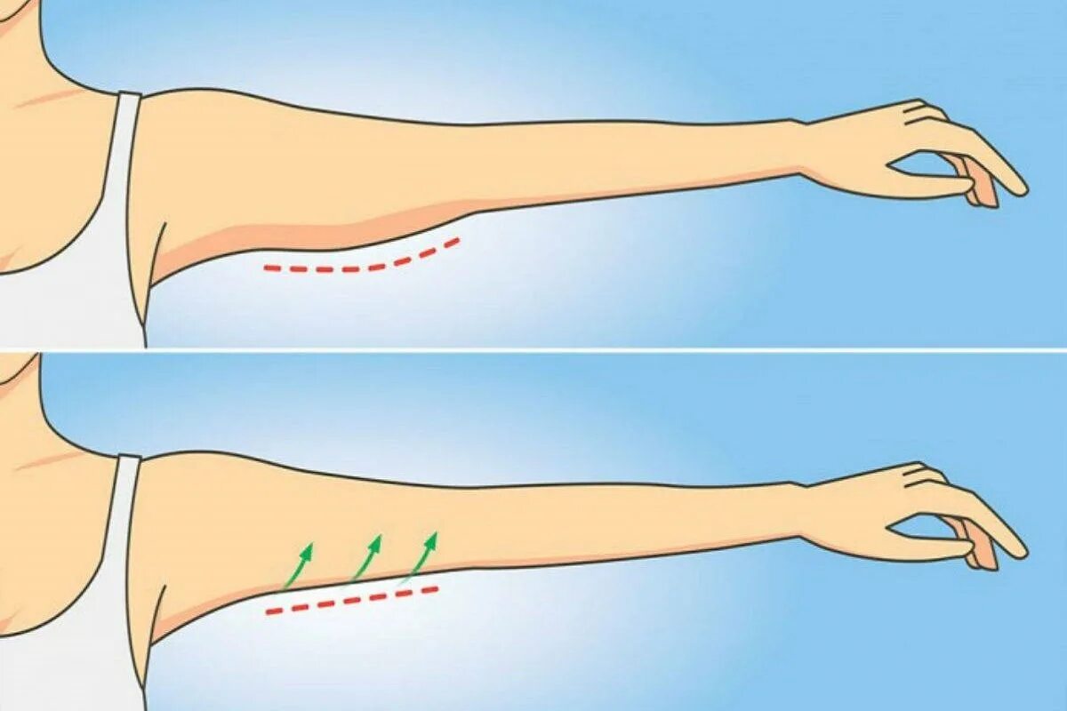 Упражнения для обвисших рук. Упражнения для обвисшей кожи на руках. Подтянуть мышцы рук. Внутренняя поверхность плеча
