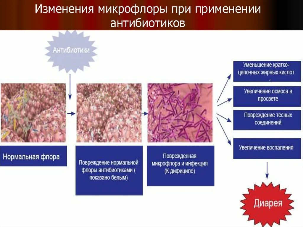 После приема антибиотиков понос. Изменение микрофлоры. Антибиотики диарея. Антибиотикоассоциированная диарея у детей. Колонизация нормальной микрофлоры.