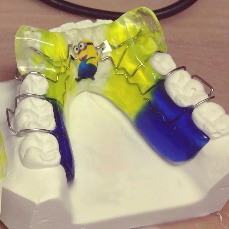 Зубные техники ортодонты. Зубные техники ортодонты. Ортодонтия в стоматологии. Твин блок ортодонтия несъемная. Ортодонтия в стоматологии.