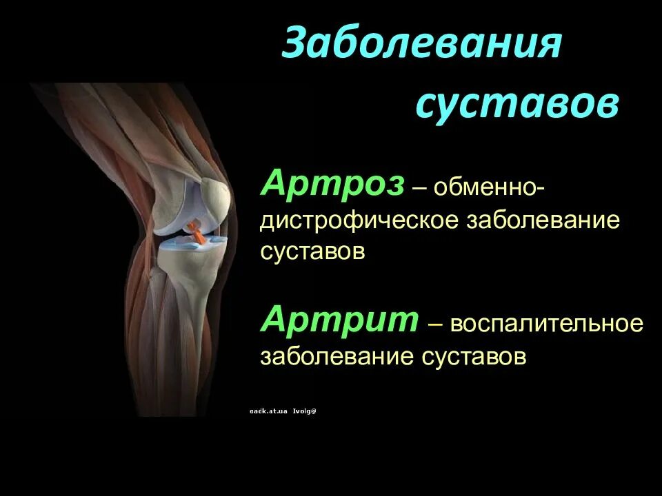 Болезни суставов список. Заболевания суставов презентация. суставные заболевания.