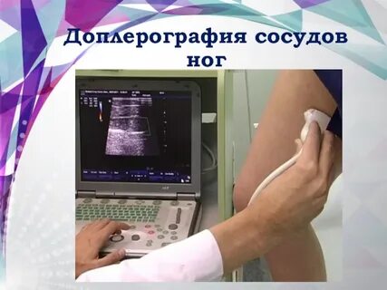 Узи артерий подготовка