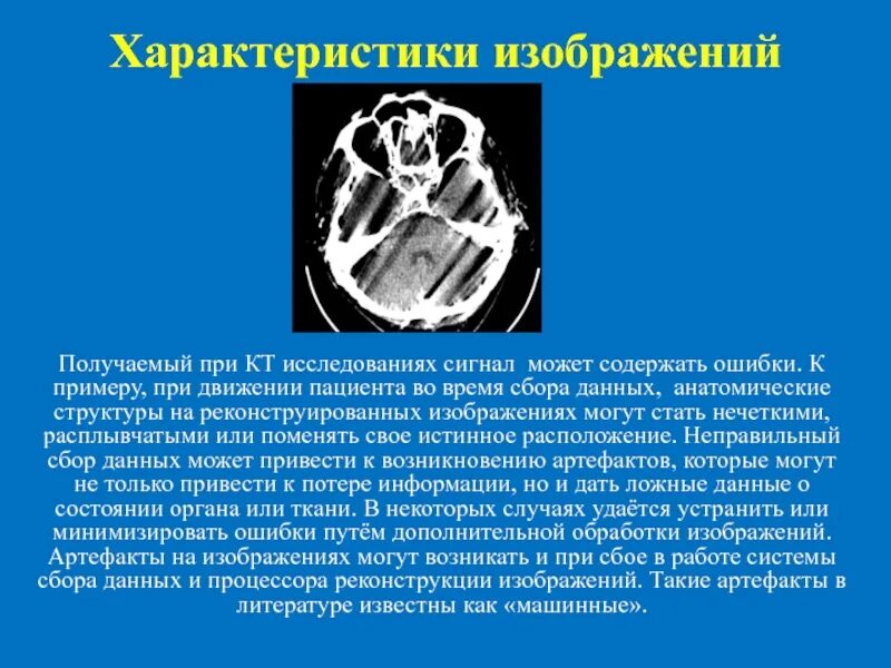 Можно по кт определить. Описание компьютерной томографии. При компьютерной томографии изображение получается. Кт особенности изображения. Компьютерная томография характеристика.