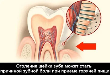 Резко начал болеть зуб