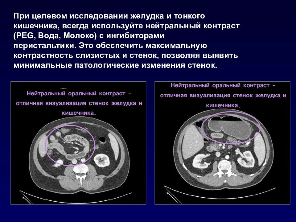 Можно по кт определить