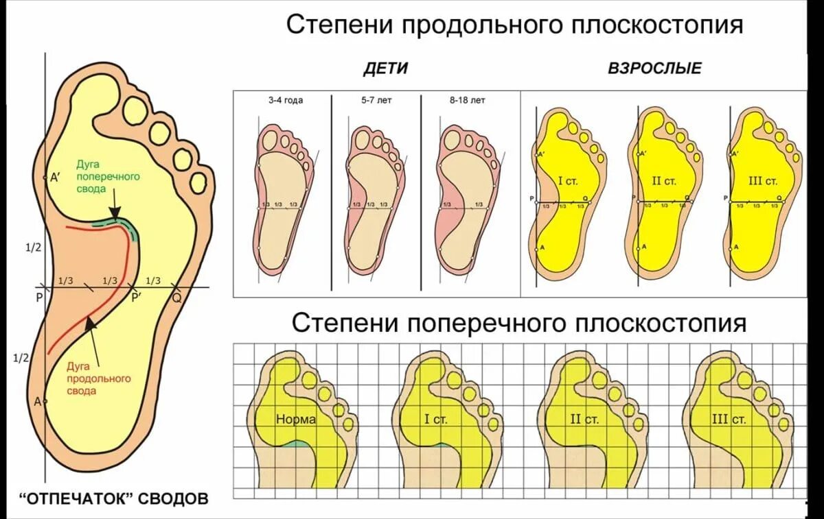 Стопа или ступня как правильно