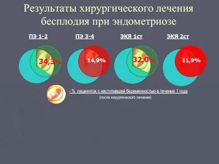 Пациентки с эндометриозом