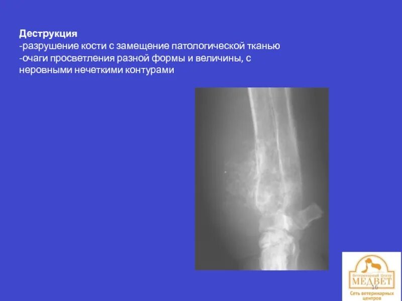 Разрушение мягких тканей костей это. Разрушение мягких тканей костей это. Перелом закрытого типа. Презентация на тему переломы костей. Разрушение мягких тканей костей это.