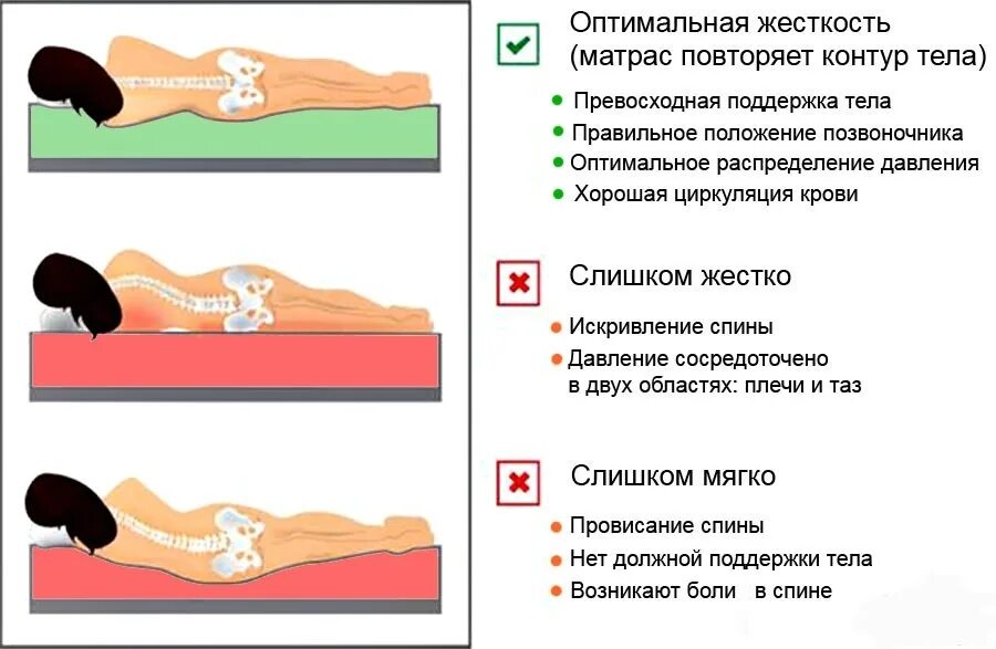 Правильное положение сна на спине. Спать при остеохондрозе. Правильная поза для сна. Правильное положение для сна.