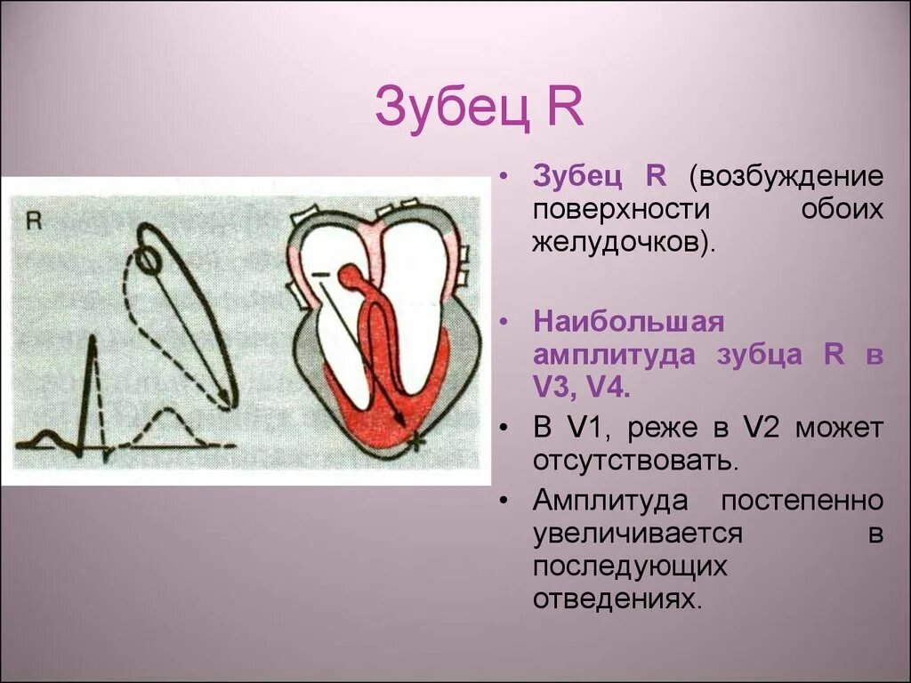 Нарастание зубца r. Зубец r. Нарастание амплитуды зубца r. Плохой ход зубца r. Плохой ход зубца r 3 v3.