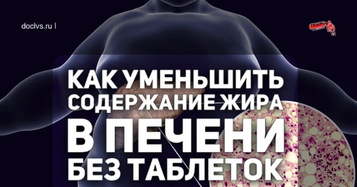 Убрать жировую печень. Лекарство от ожирения печени. Жировая болезнь печени. Жировой гепатоз печени таблетки. Ожирение печени гепатоз печени.