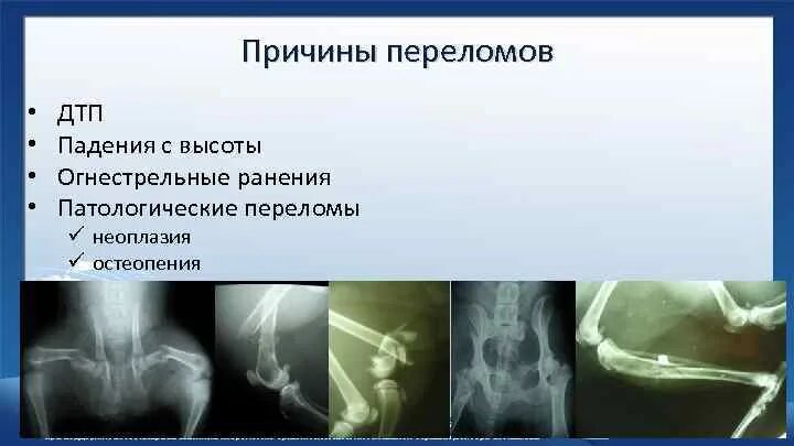 Почему сломан. Первая помощь при переломе костей носа. 1 помощь при переломе носа. Причины повреждения костей таза. Причины переломов костей.
