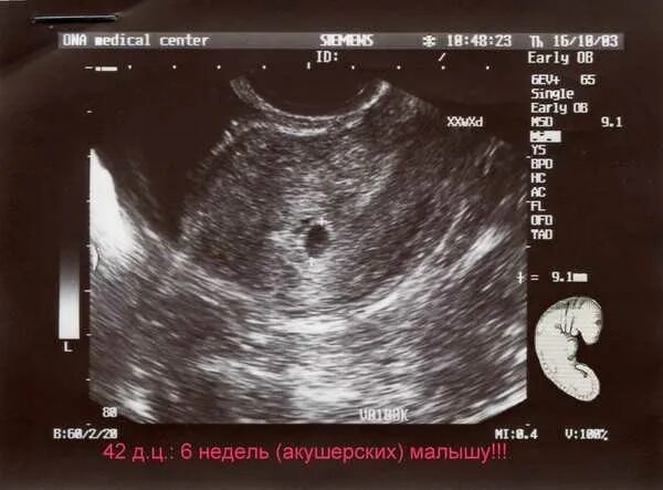 Вес плода в 38 недель беременности. 37 неделя акушерской беременности. Хгч при беременности норма по неделям таблица. 37 неделя акушерской беременности. Живот на 37 неделе беременности.