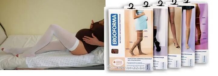 Зачем надевают компрессионные чулки. Medi bayreuth компрессионные чулки. Чулок компрессионный. Компрессионные чулки на роды. Приспособление для одевания компрессионных чулков.