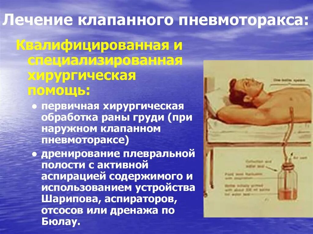 Лечение открытого пневмоторакса. Пневмоторакс лечение. Симптомы открытого пневмоторакса. Лечение открытого пневмоторакса. Лечение клапанного пневмоторакса.