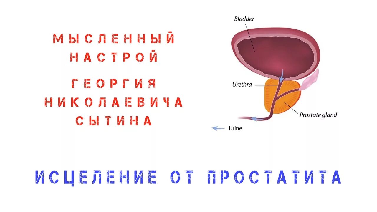 Женский простатит. Настрой Сытина от аденомы предстательной железы. Настрои Сытина от аденомы. Квантовое исцеление простаты. Лечение простатита вектор.