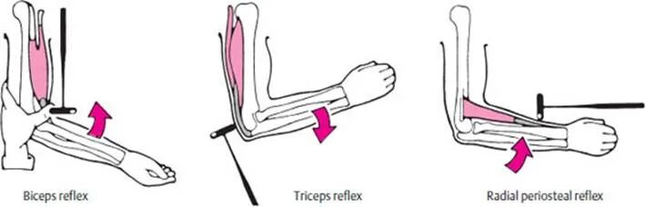 Рефлекс плеча. Рефлекс двуглавой мышцы. Рефлекс сухожилия двуглавой мышцы. Рефлекс двуглавой и трехглавой мышцы. Рефлекс сухожилия трехглавой мышцы.