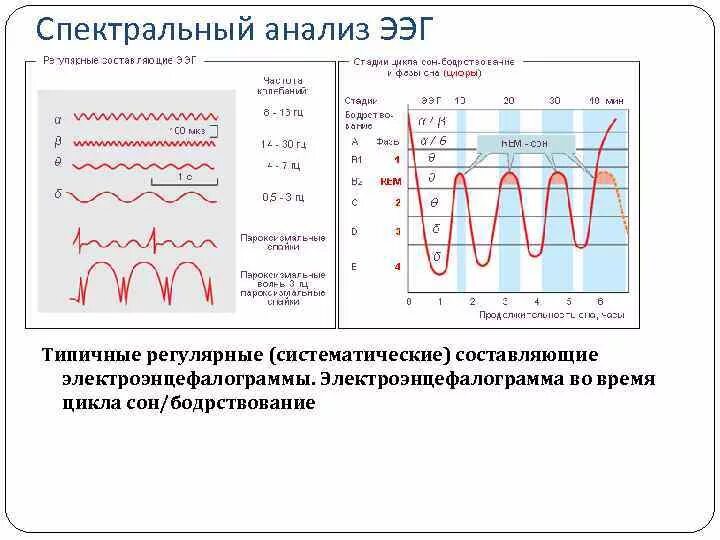 Анализ ээг