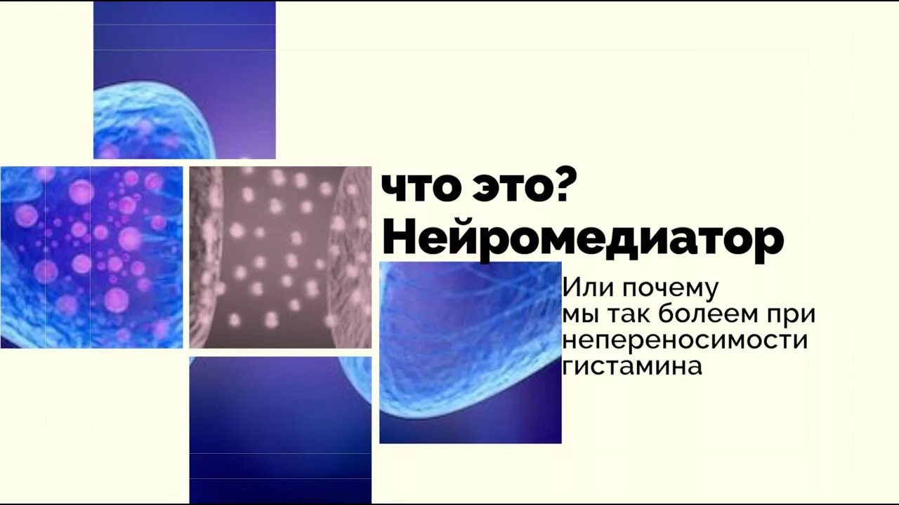 Гистаминоз симптомы. Гистаминоз диагностика. Гистаминоз гайд.