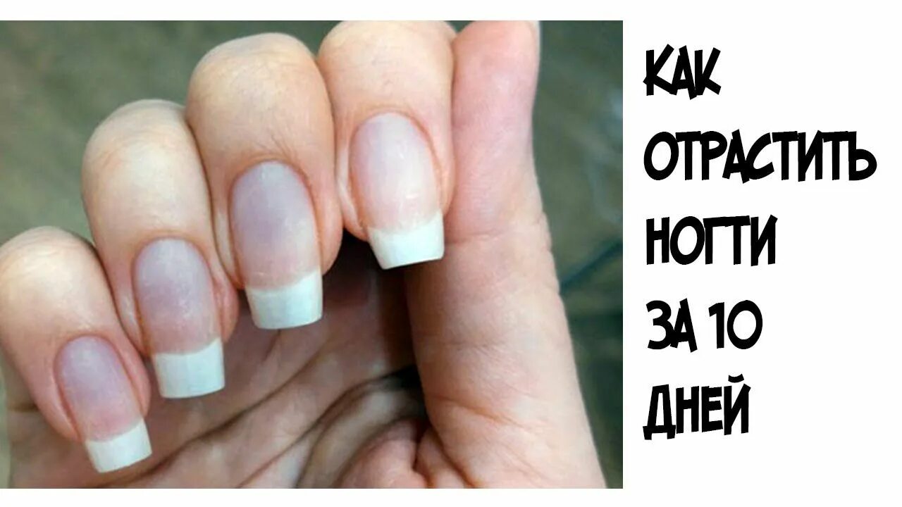 Отращиваю ногти в 12. Как отрастить ногти за 10 дней. как нарастить ногти за неделю. как можно за неделя нарастить ногти. рост ногтей за 10 дней.