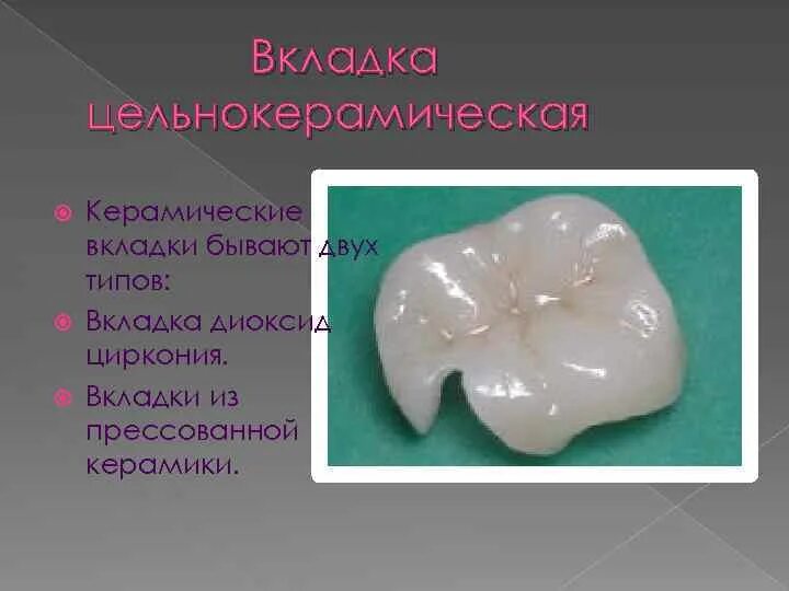 Керамическая вкладка емакс. Культевая вкладка кариес. Вкладки хоткеями. Вкладки хоткеями. Вкладки хоткеями.
