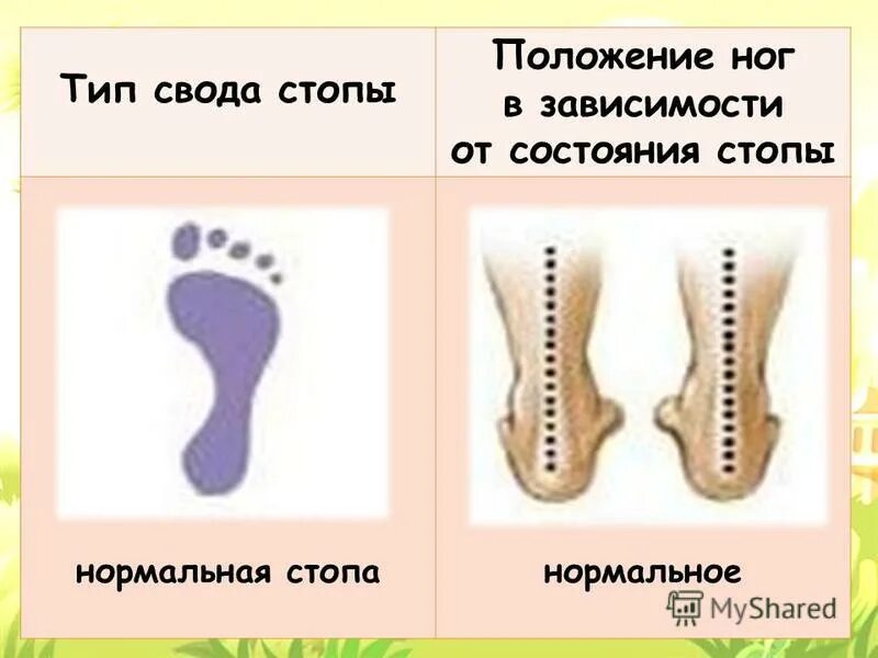 вальгусная деформация 3д. варусная и вальгусная деформация стоп. положение ног у детей. вальгусная и варусная деформация стопы. вальгус и варус стопы у ребенка.