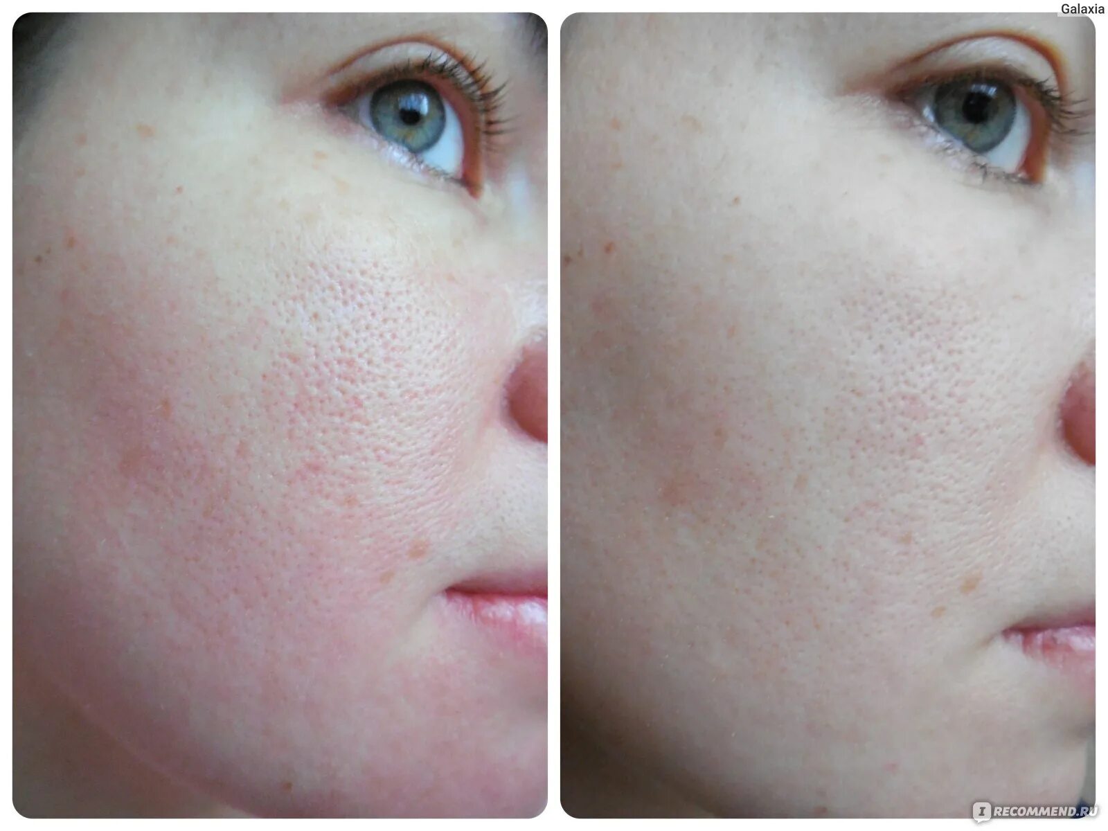 Neulii niacinamide 10. Neulii niacinamide 10 brightening ampoule. опатра сыворотка серума. сыворотка или крем для лица. сыворотка для лица бренд бейтесьтик.