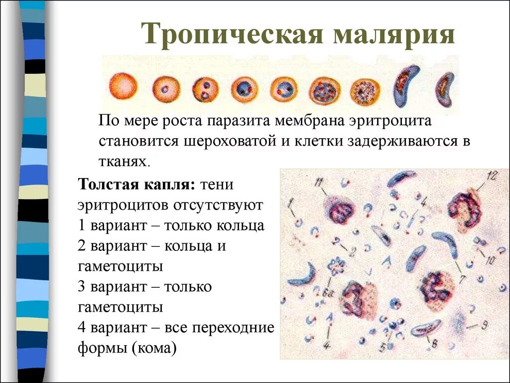 Изменение свойств эритроцитов при тропической малярии