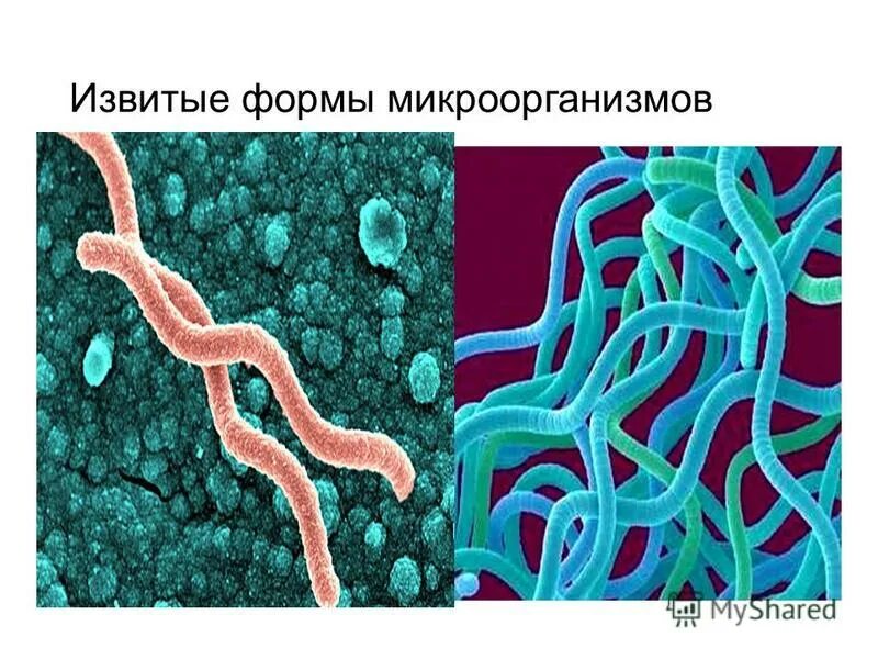 Реакция иммобилизации бледных трепонем (рибт). Темнопольная световая микроскопия. Возбудитель трепонема. Антигенная структура сифилиса. Диагностика трепонемы.