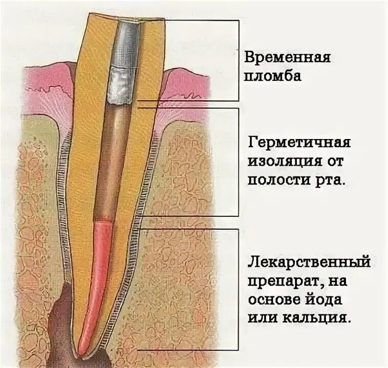Седация в стоматологии - что это такое, как проводится, седация для детей и взро