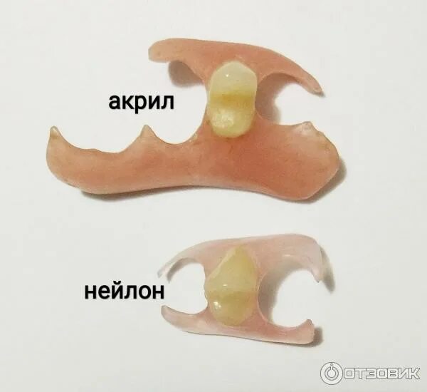 Изготовление иммедиат протеза. Микропротез бабочка/ иммедиат-протез. Протез микропротез бабочка. Съемный микропротез 1 зуб. Зубной иммедиат протез бабочка.