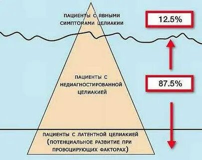 Очевидных признаков