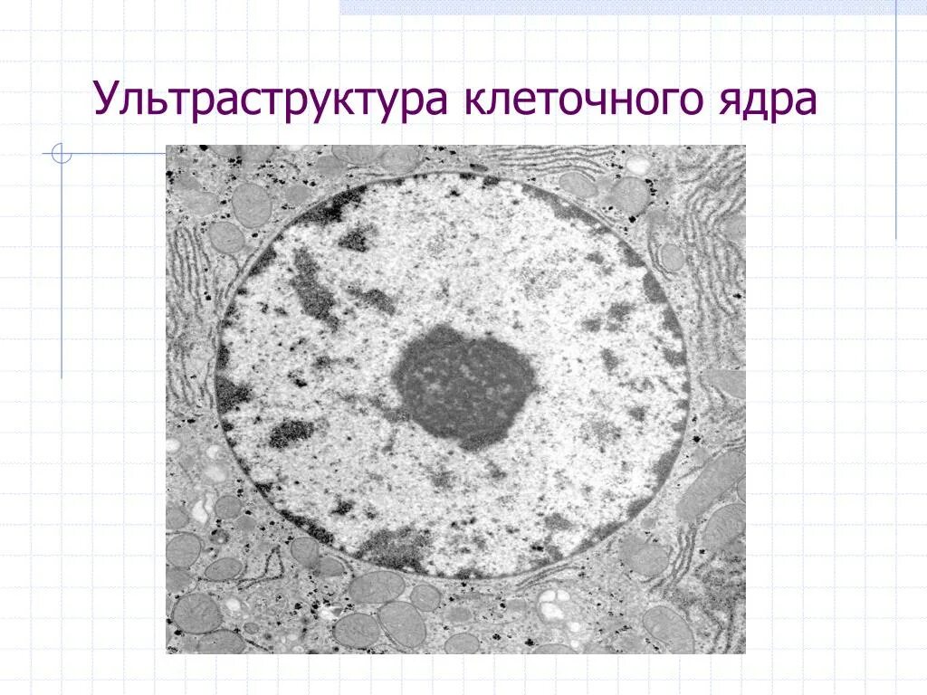 Ультраструктура ядрышка. Ультраструктура ядрышка гистология. Ультраструктура клеточного ядра. Ядро и ядрышко строение. В ядрах клеток многоклеточного