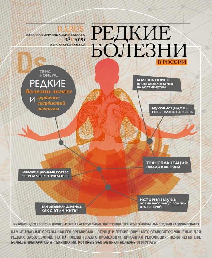 Перечень редких заболеваний. Редкие заболевания названия. Редкие заболевания названия. Орфанное заболевание что это такое перечень. Редкие заболевания названия.