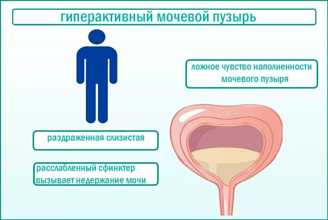 Непроизвольное Мочеиспускание У Женщин Во Время Секса