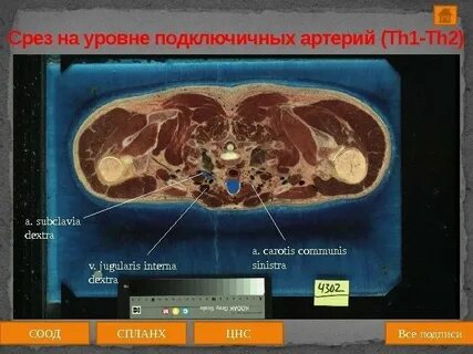 Срез первых