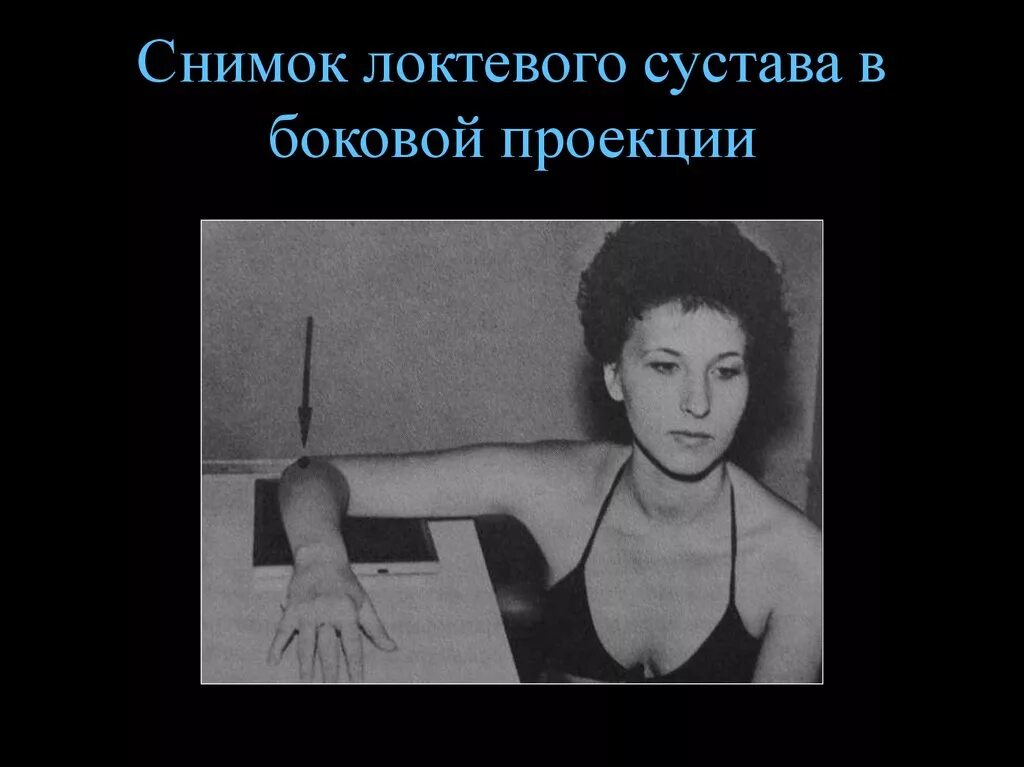 Проекции локтевого сустава. Проекции локтевого сустава