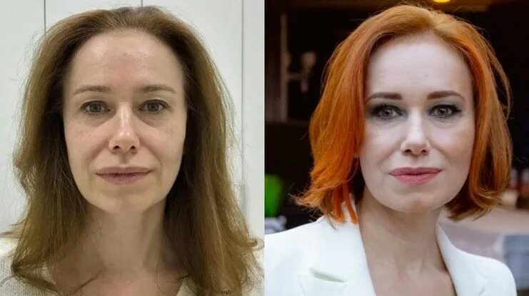 Как выглядели женщины как не ухаживали. Преображение на первом канале. Преображение героини. Преображение героини. Преображения героини для журнала картинки.