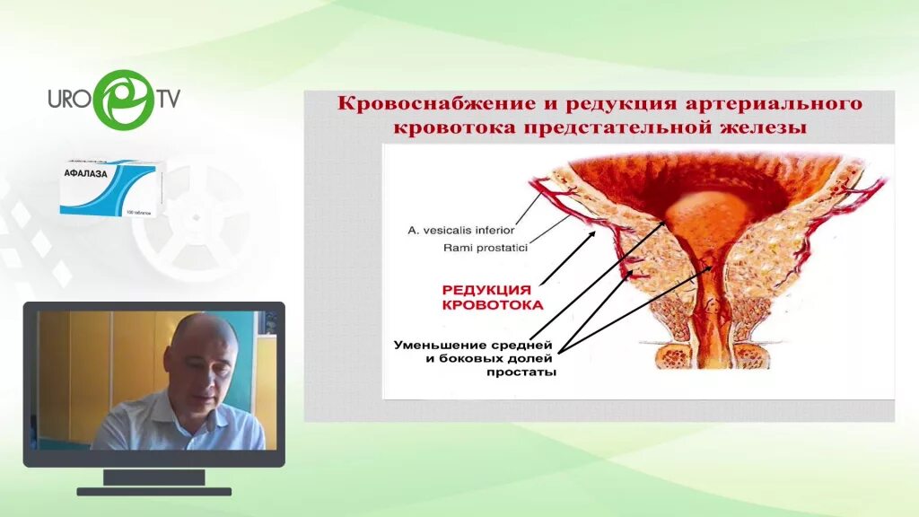 Артерии простаты. Кровоснабжение предстательной железы. Сосуды предстательной железы. Кровоснабжение предстательной железы осуществляют. Эмболизация предстательной железы.