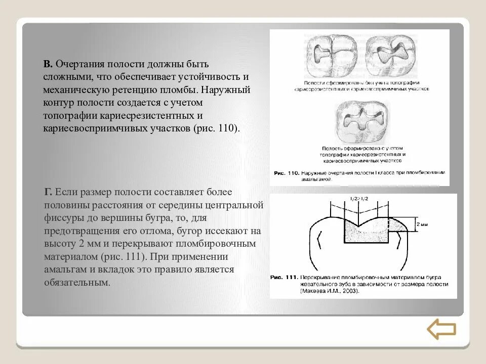 Пломбирование кариозных полостей 5 класса. Полости 1 класса по блэку. препарирование кариозной полости.