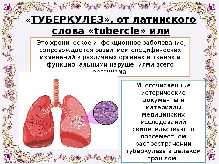 Туберкулез рассказать