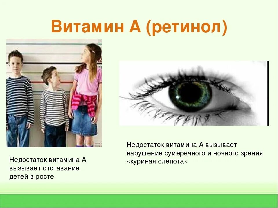 Признаки дефицита а. Недостаток витамина а в организме вызывает. Недостатокмвитамина а. Недостаток витамина к приводит к. Дефицит витамина к приводит.