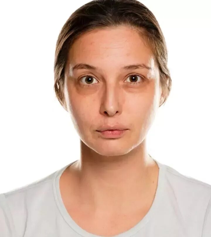 Лицо уставшей женщины. Sunken eyes. Dark circles. Sunken eyes girl. Sunken eyes.
