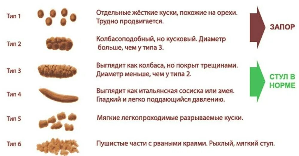 Как сходить по большому при запоре быстро. Запор виды кала. стул при запоре. норма стула у взрослого. нормальный вид кала у ребенка.
