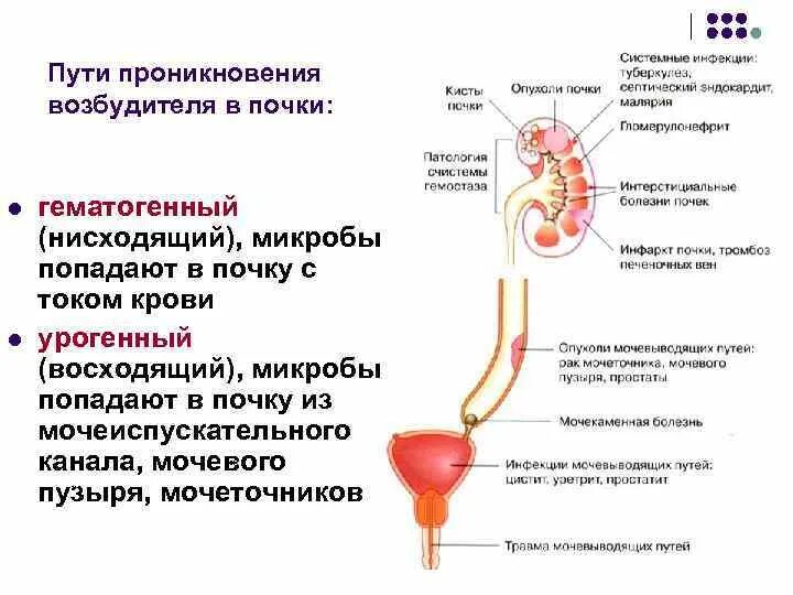 Мочеточник почечная лоханка мочеиспускательный канал мочевой пузырь. Пути проникновения гломерулонефрита. Гематогенный путь проникновения инфекции в почки. Строение мочеточника. Мочевыводящие пути почки.