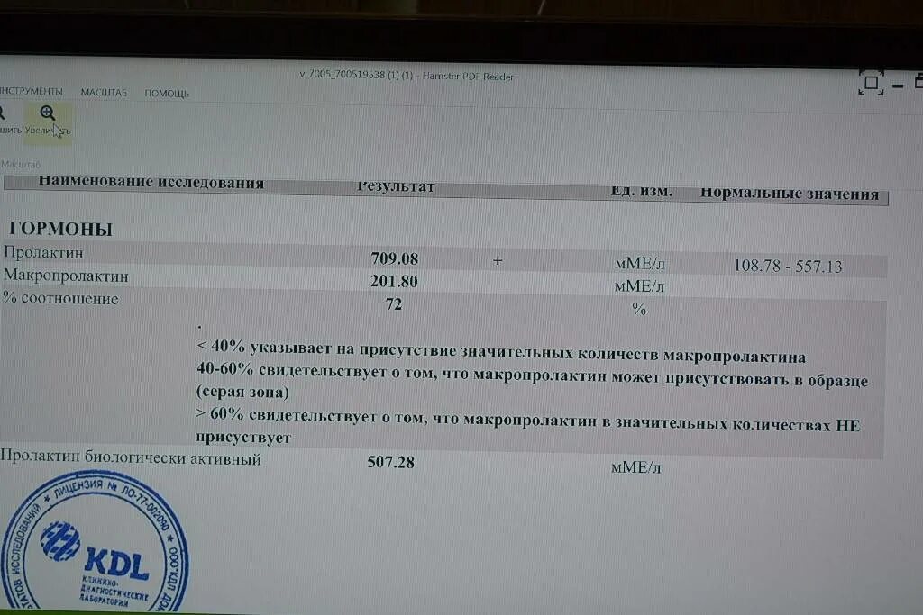 Пролактин макропролактин повышен. Мономерный пролактин анализ. Пролактин и макропролактин расшифровка анализа. Макропролактин биологически активный норма. Пролактин и макропролактин.