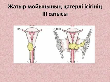 Lexi Fox порно видео